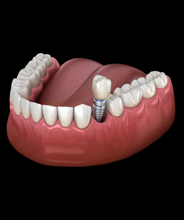 Foundation of a Healthy Smile Starts Here