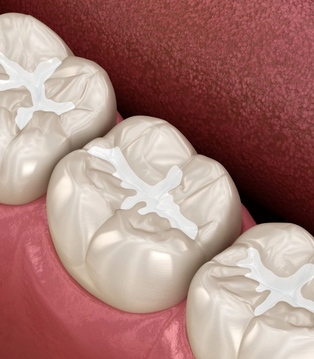 Easiest Way to Protect Your Teeth From Cavities